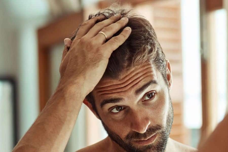 Hair Loss