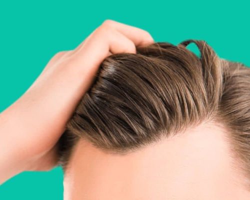 Hair Loss Treatment