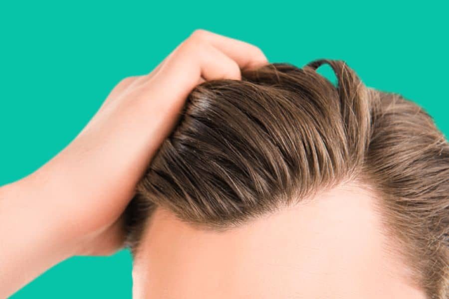 Hair Loss Treatment